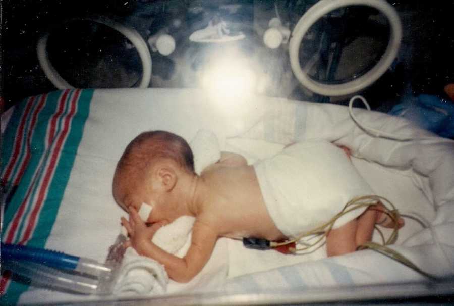 Newborn premature baby girl lying in incubator hooked up to machines