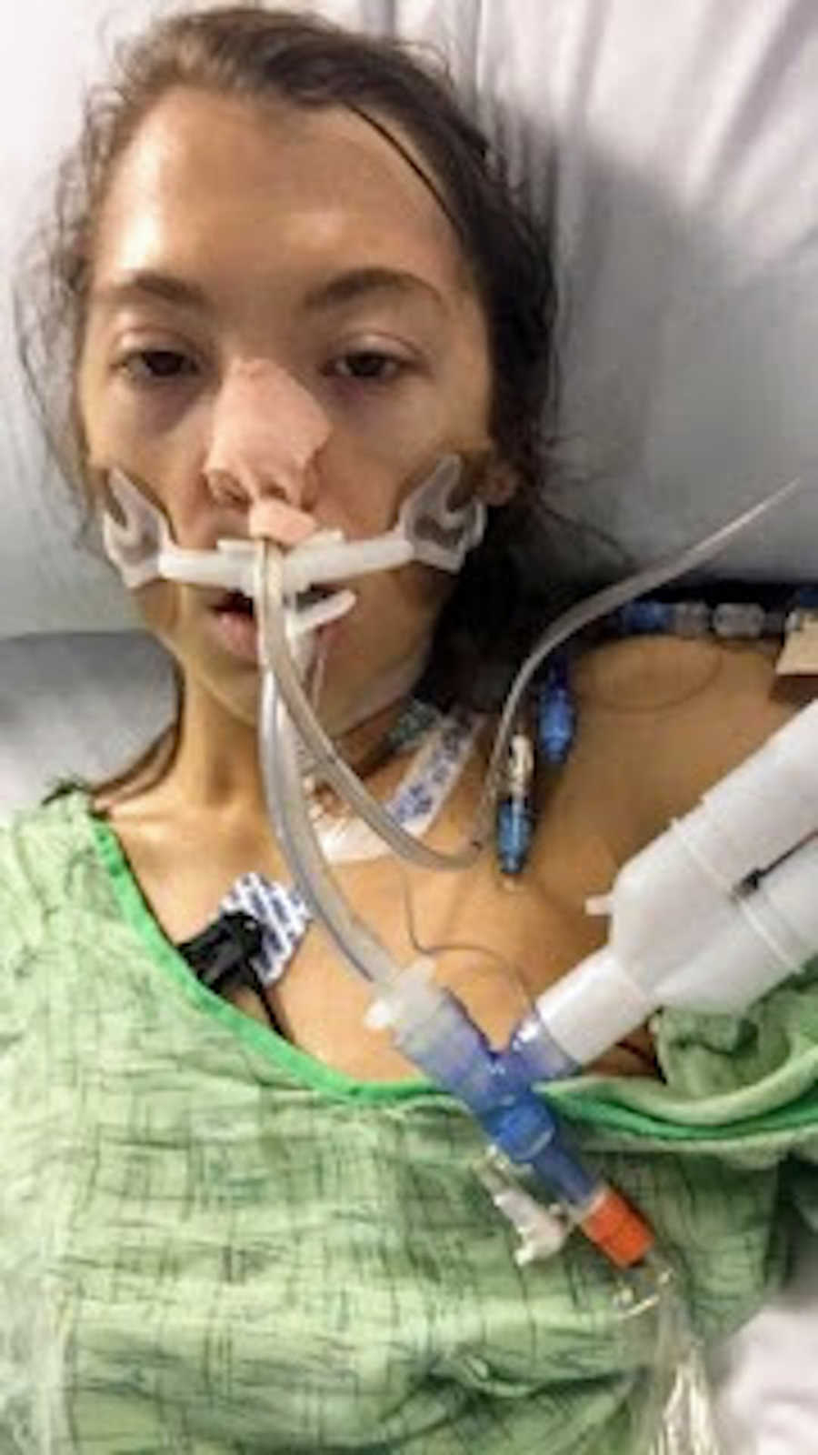 Woman on ventilator taking selfie after lung surgery