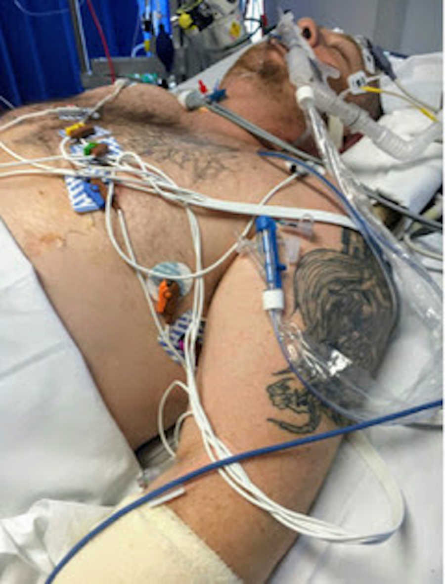 Man in hospital bed on ventilator covered in wires