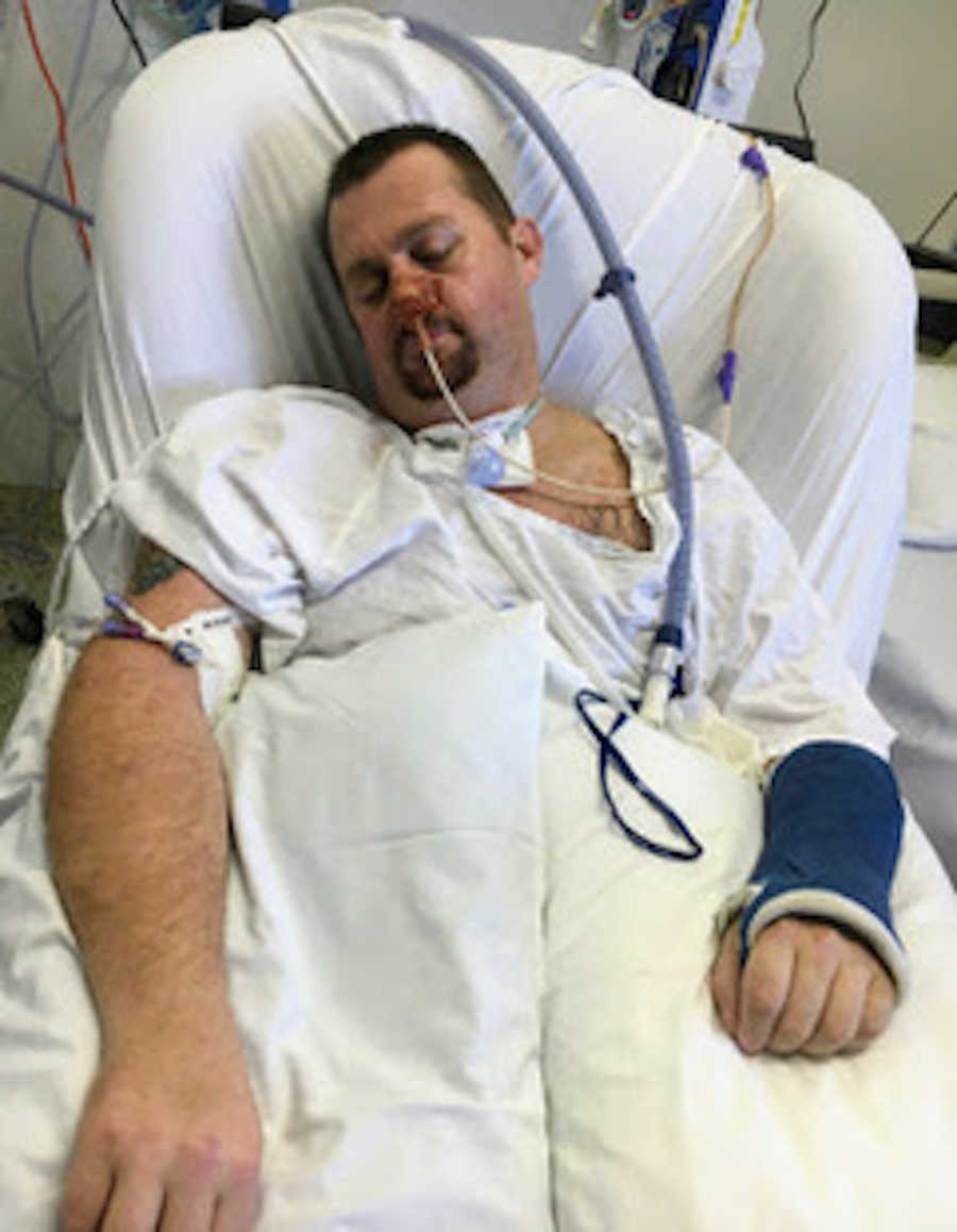 Man in hospital bed with arm cast and feeding tube