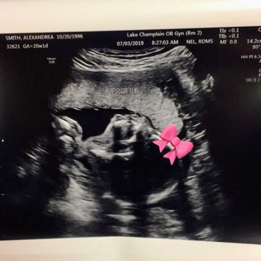 First time mom takes a photo of daughter's autonomy scan