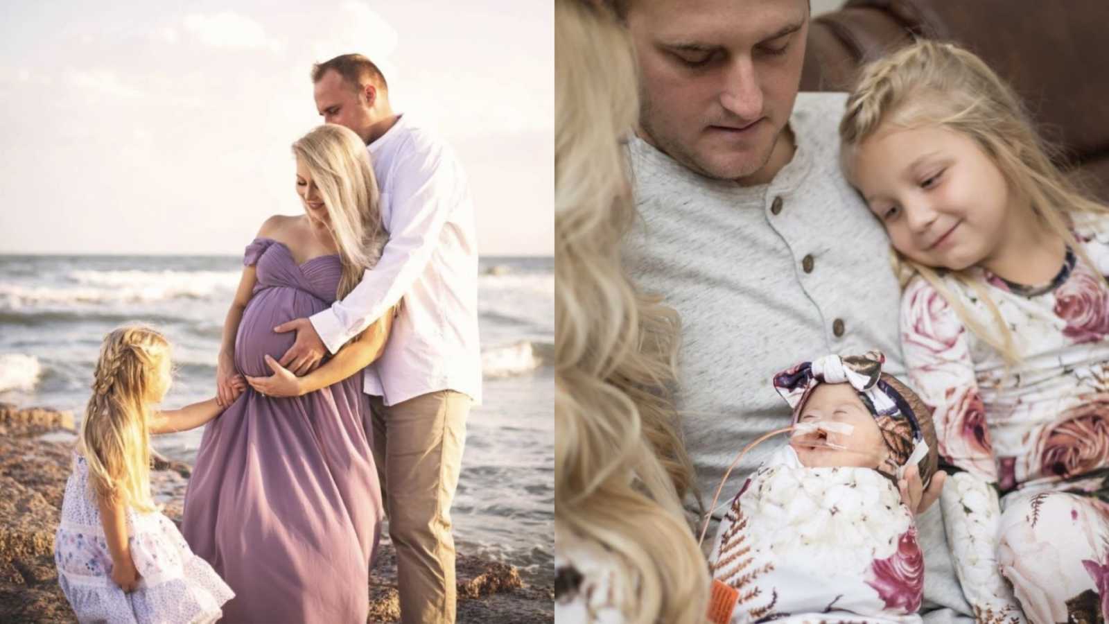 On the left, family of three take pregnancy photos on the beach, on the right, family of three hold newborn with Alobar Holoprosencephaly