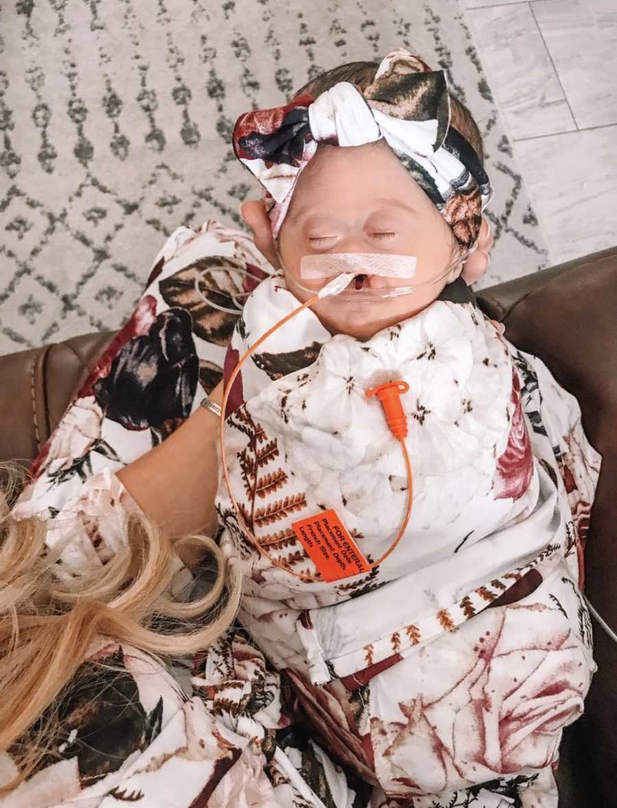 Mom snaps photos of her sweet, sleeping newborn with Alobar Holoprosencephaly