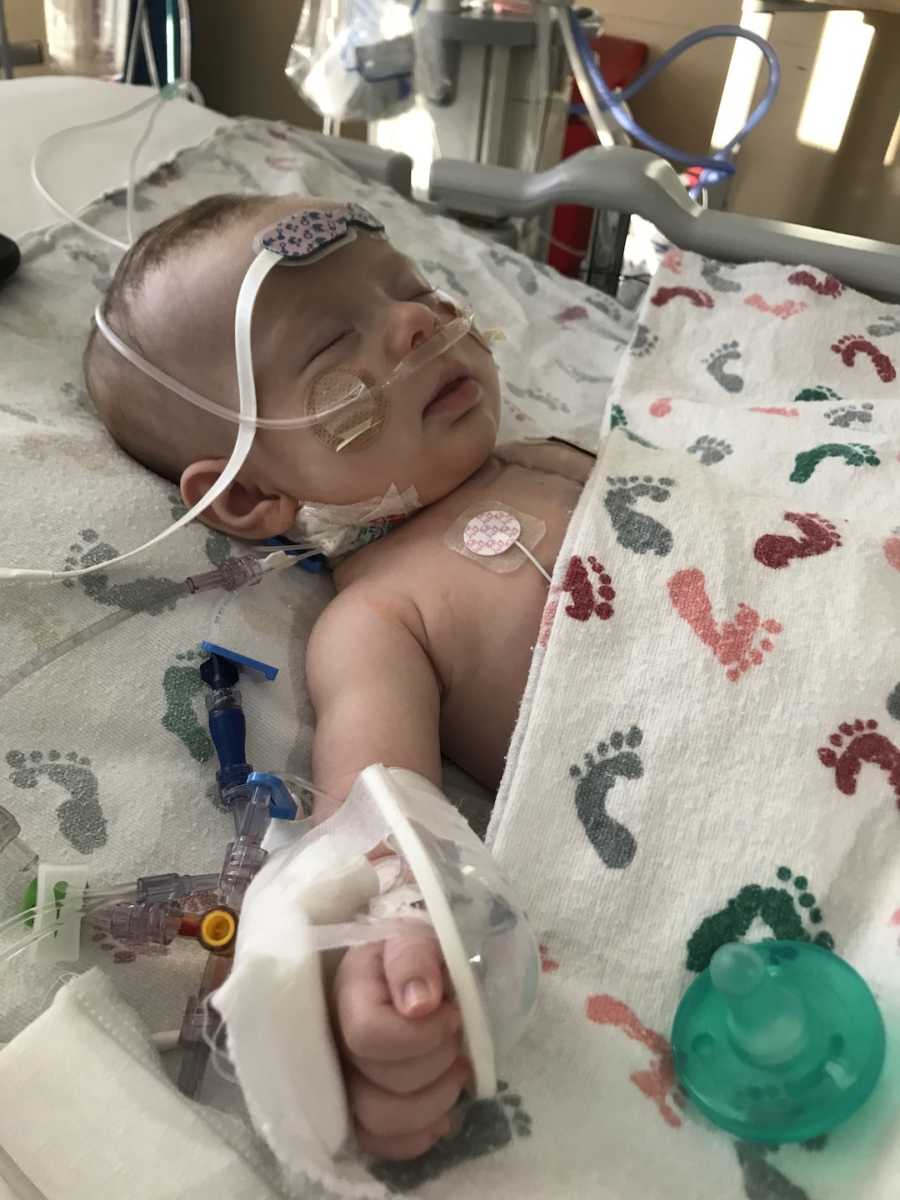 baby hooked up to wires for EKG