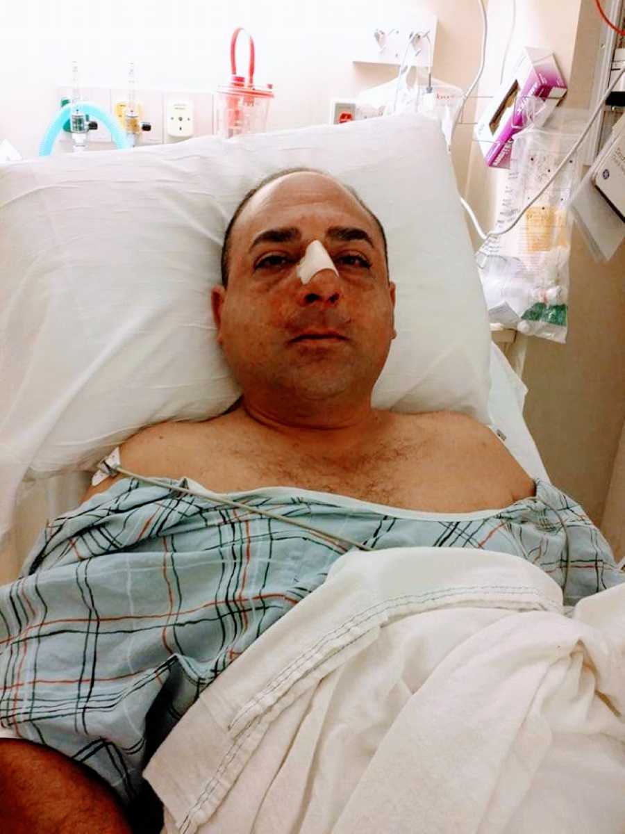 Guy lays in hospital bed with gauze on his nose after nasal surgery