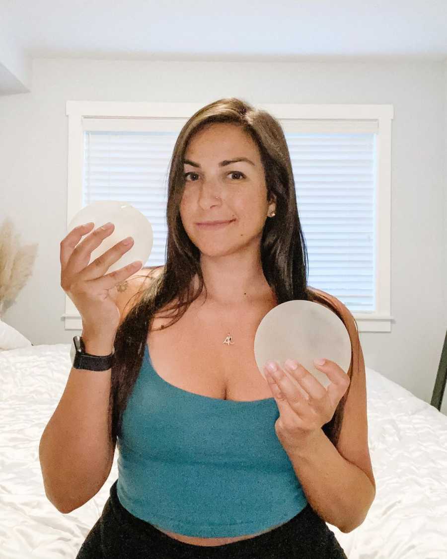 woman holding breast implants 