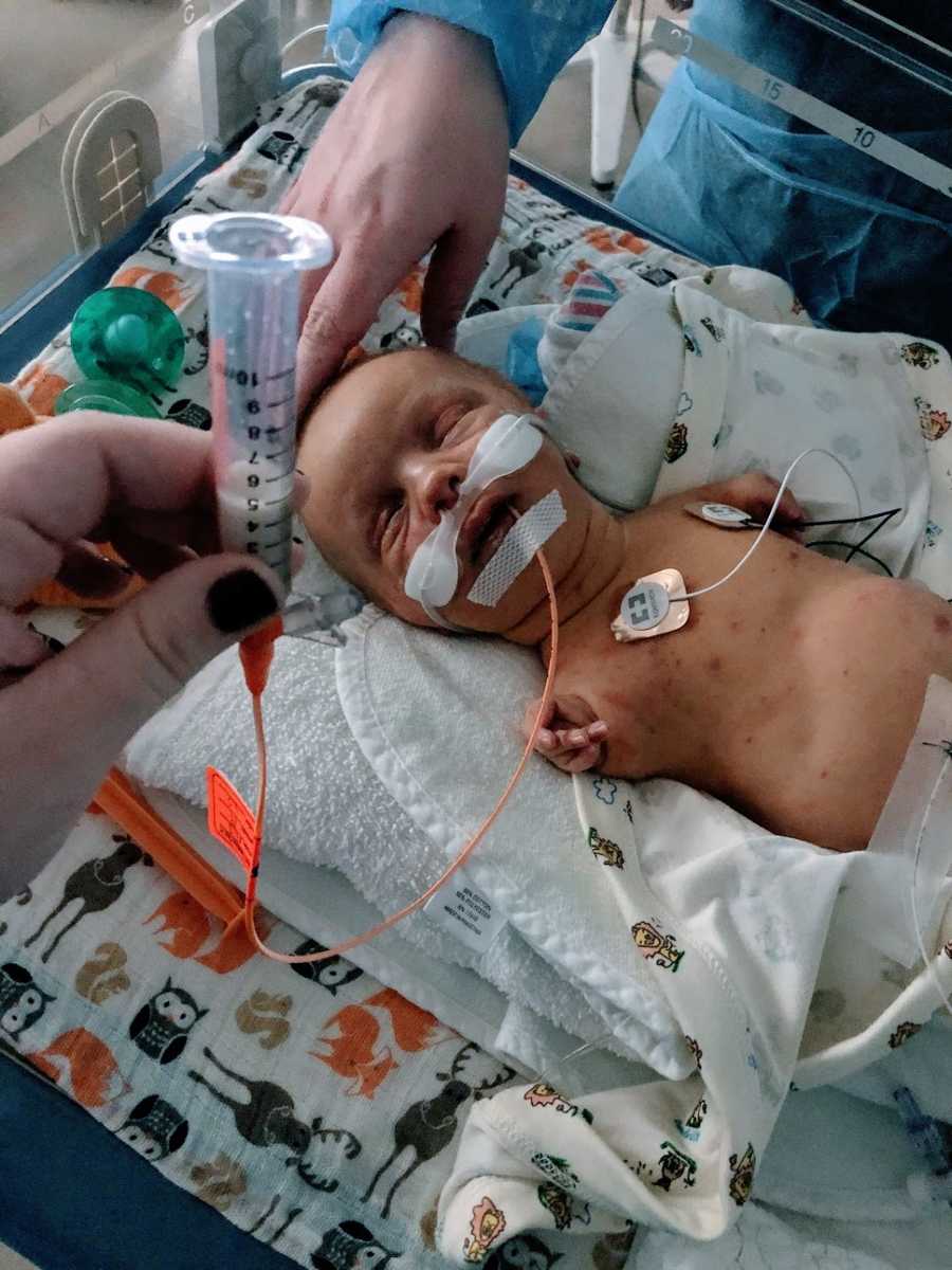 A baby boy with no arms lies in a hospital bed