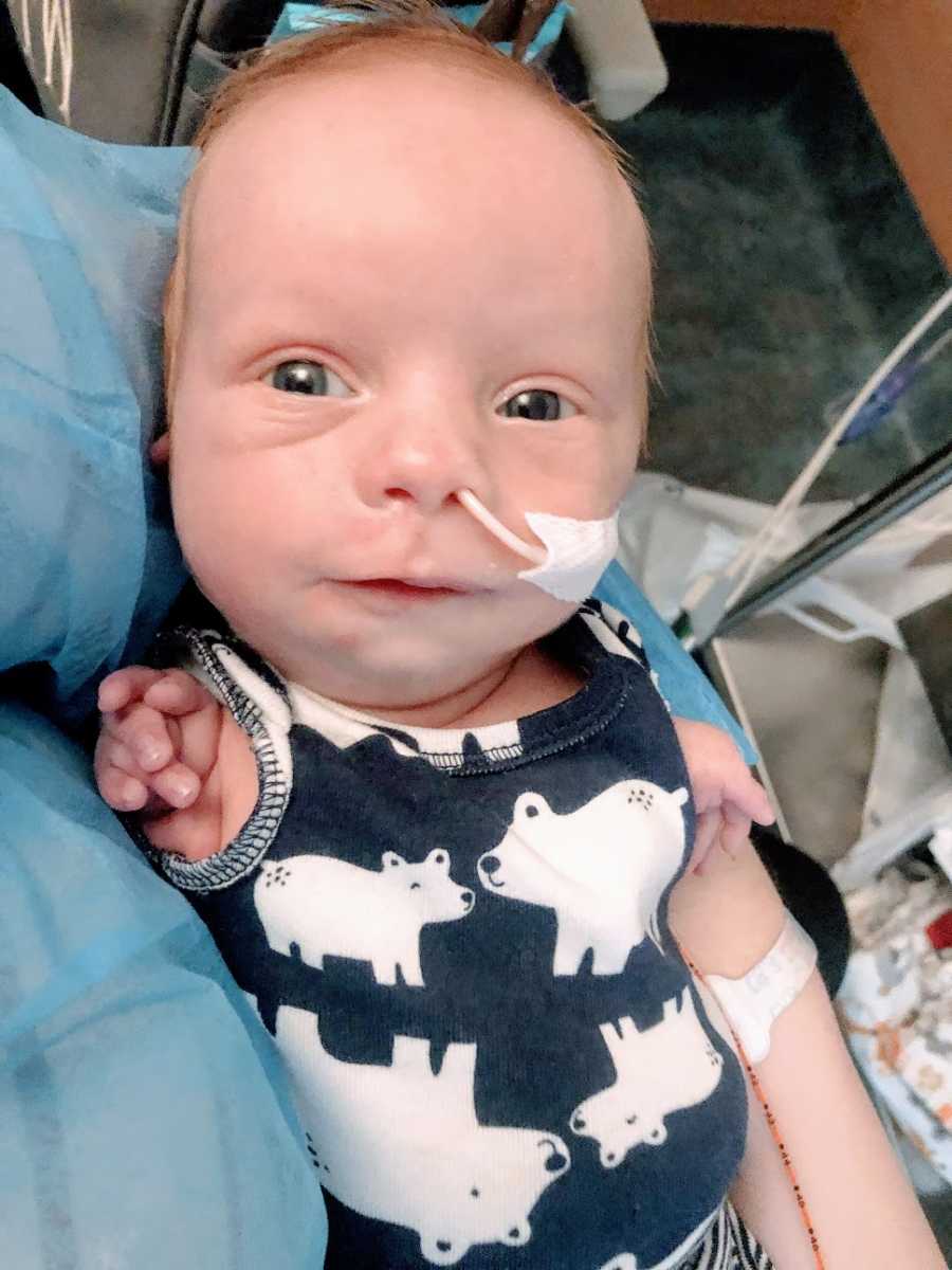 A baby boy without arms wears a feeding tube
