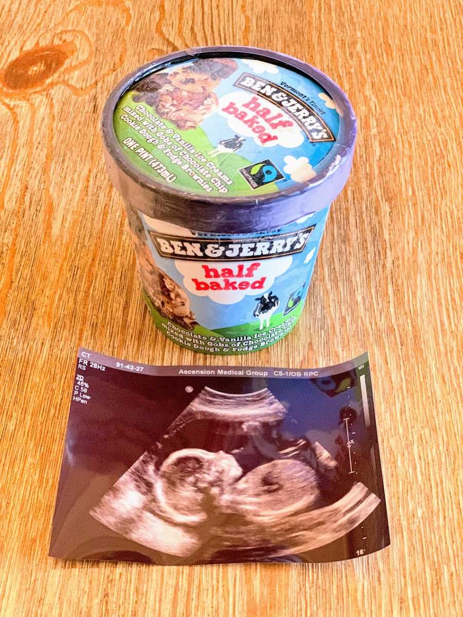 A container of ice cream next to an ultrasound photo