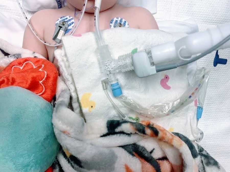 A little girl lies in a hospital connected to wires