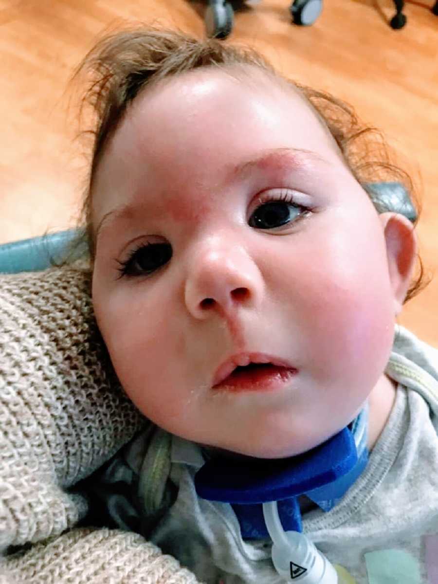 A little girl with a medical tube in her neck