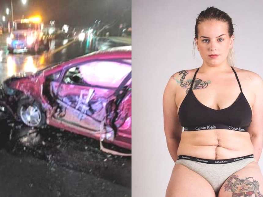 car crash, woman in underwear with surgery scar