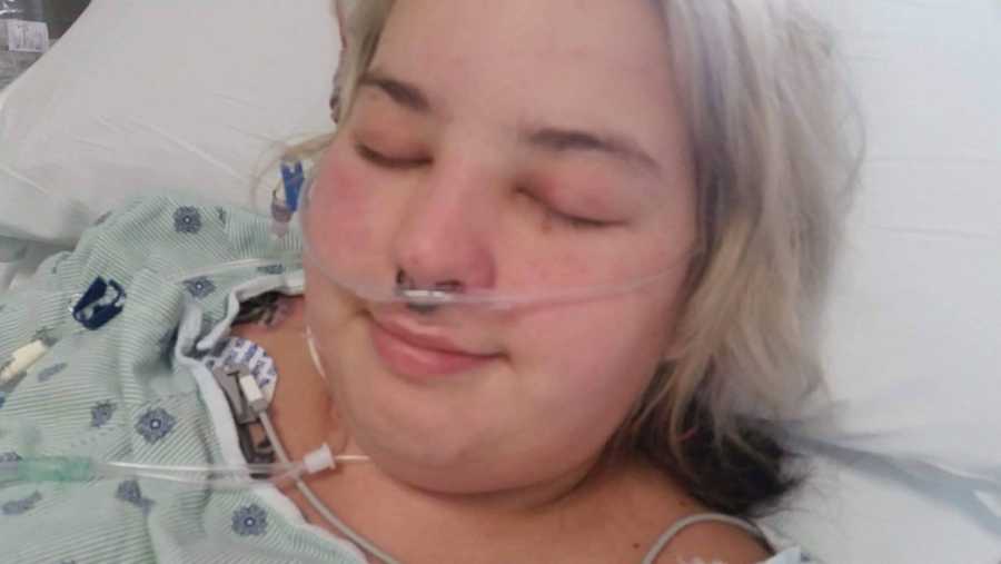 woman with a breathing tube
