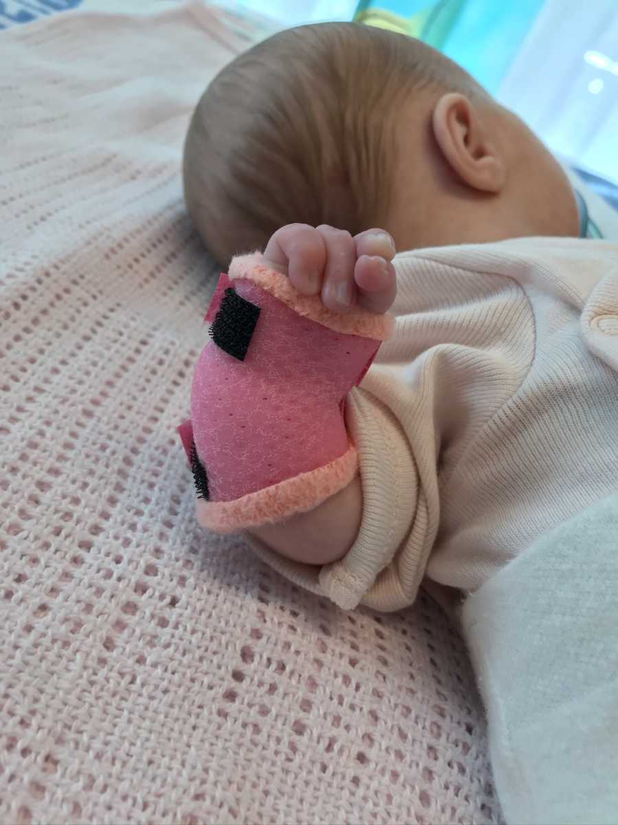 baby with arm in a cast