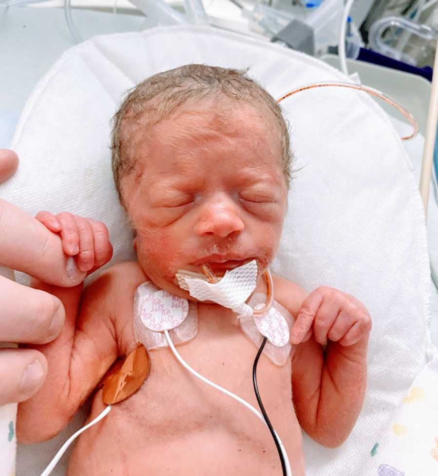 Young mom snaps photo of her preemie rainbow baby born at 2 pounds with a head full of hair