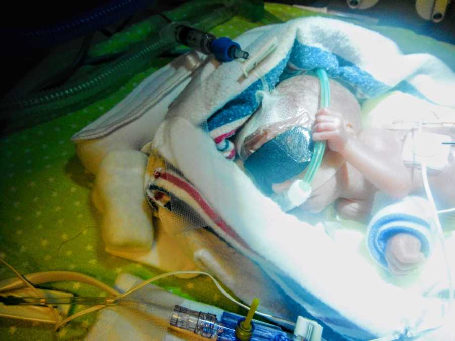 Little baby girl fighting for her life in the NICU is swaddled in blankets and wires