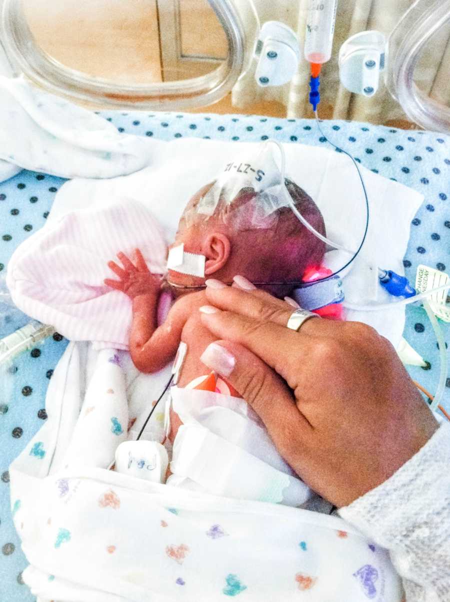 Mom puts her hand on her newborn preemie daughter to show just how small she is