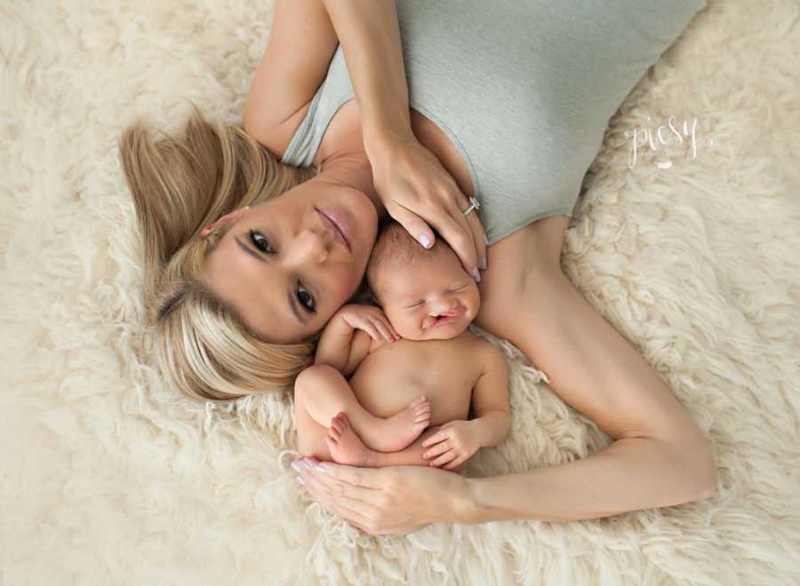 A mother lies with her baby who has cleft lip