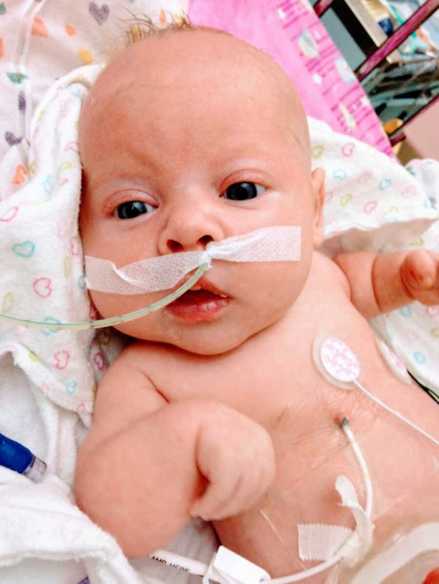 Newborn baby girl with dwarfism looks at the camera while her mom snaps a photo of her in the hospital