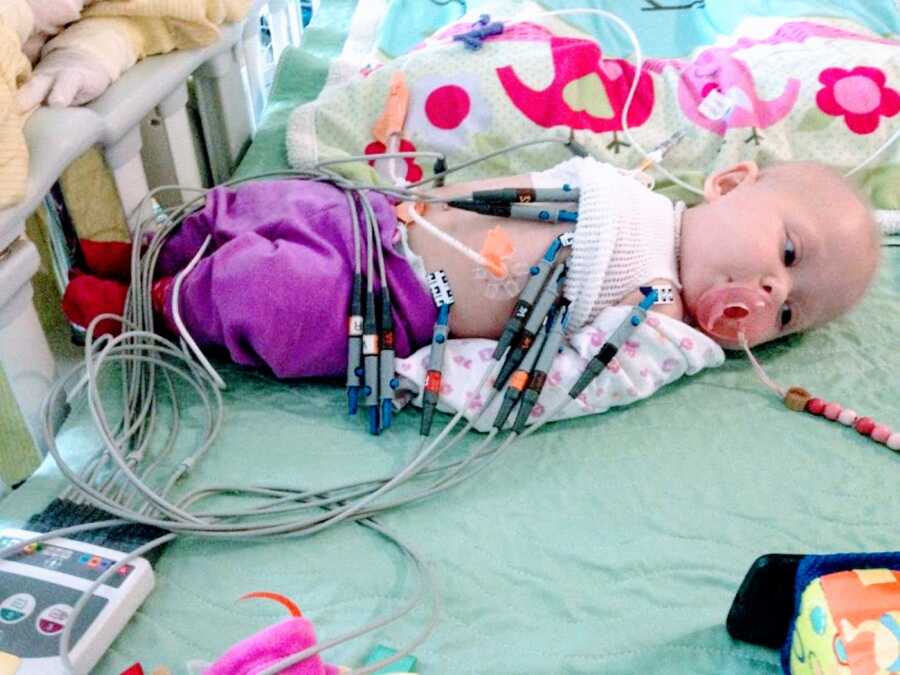 Little girl born with no immune system and multiple rare diseases stays calm while attached to numerous tubes and devices