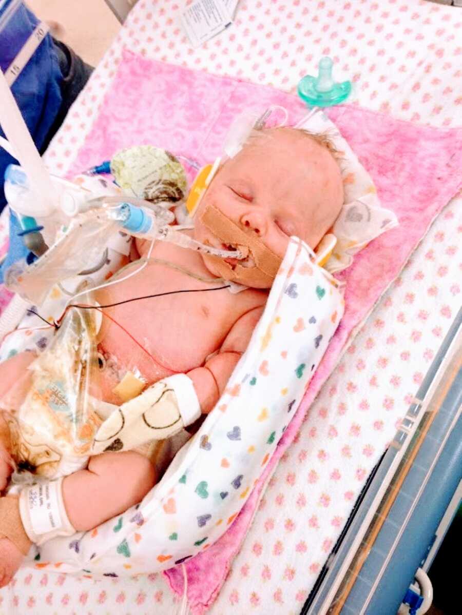 Newborn girl born with dwarfism and multiple rare conditions sleeps on a pink blanket while being attached to various needles and tubes