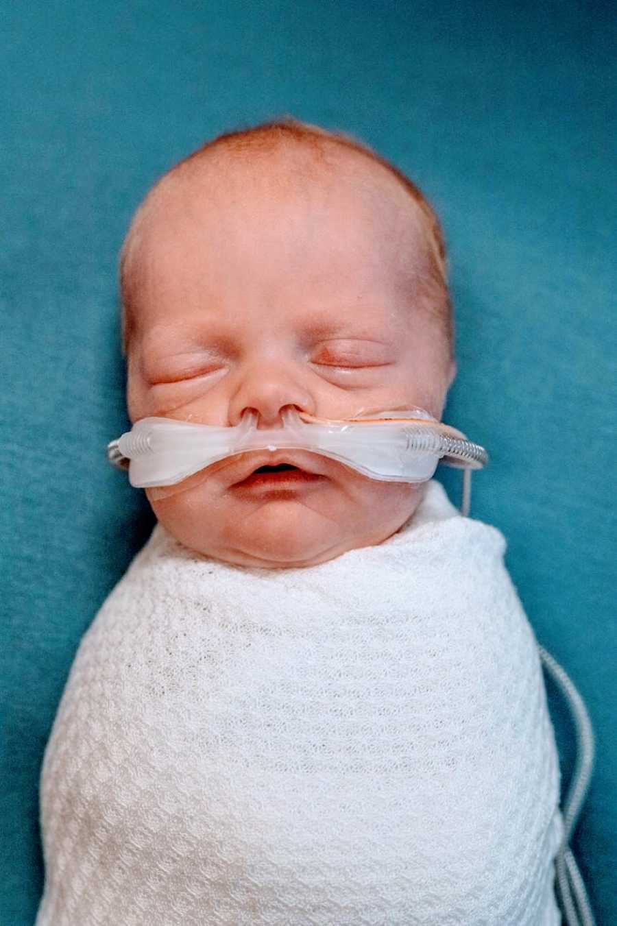 Mom shares photo of newborn baby swaddled in a white blankets with tubes in his nose