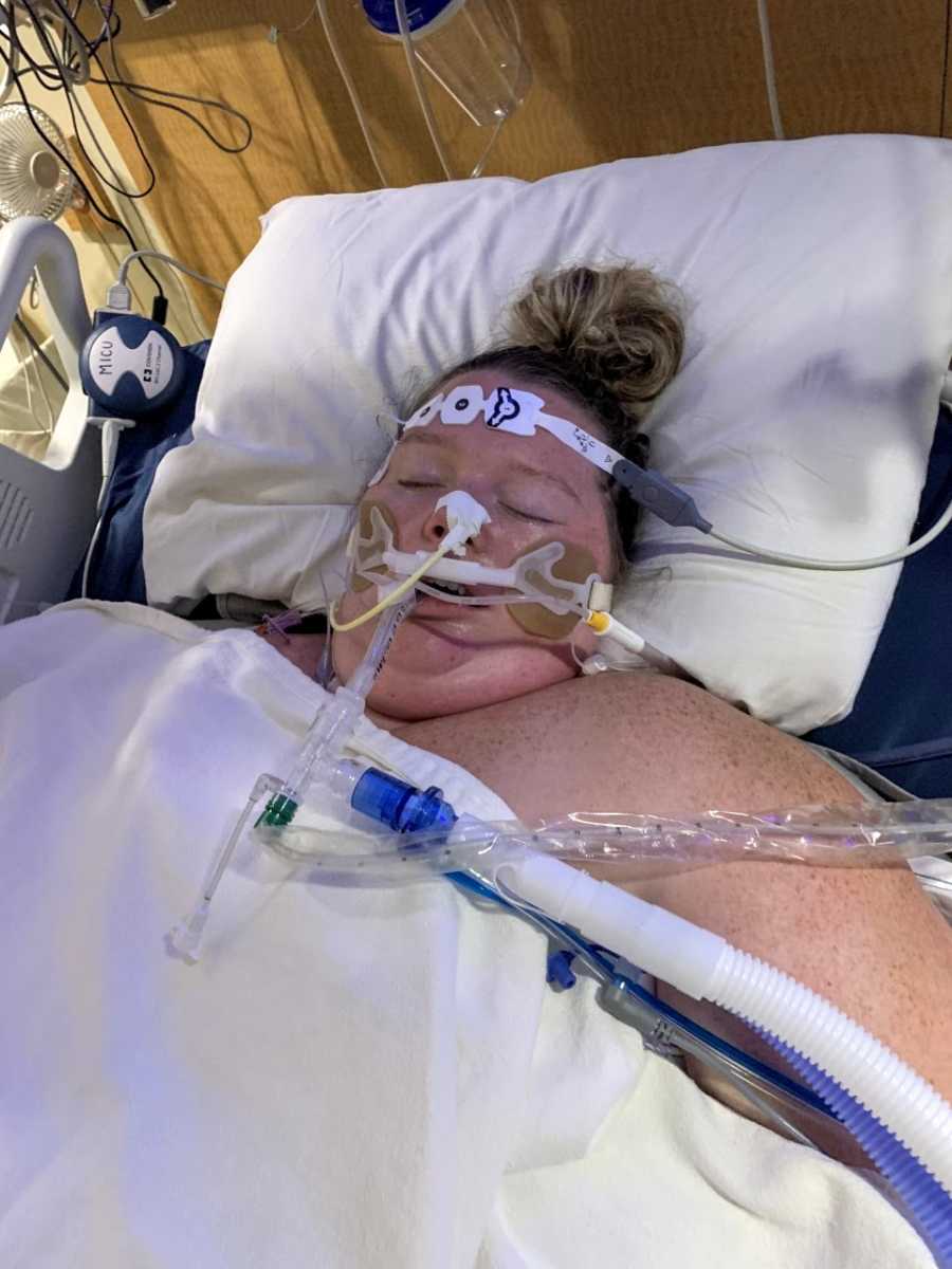 Pregnant woman with post-covid pneumonia gets intubated and paralyzed for an emergency C-section