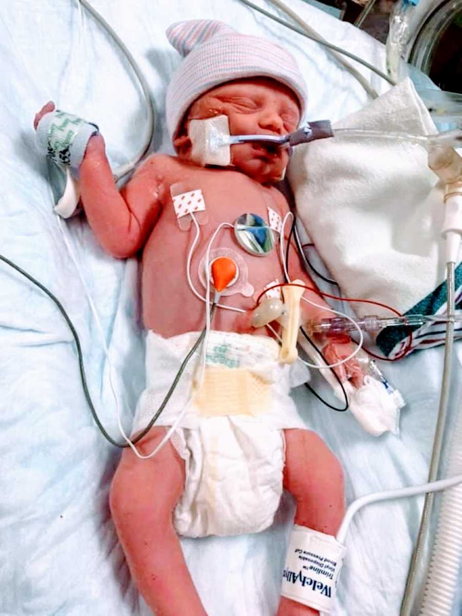 First time mom takes photo of her newborn son attached to a bunch of wires after an emergency C-section