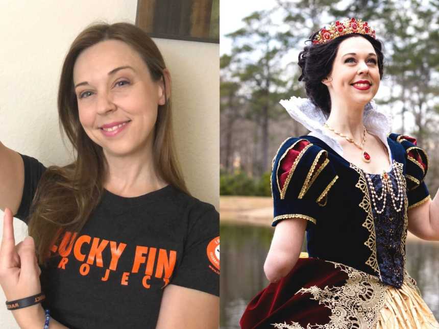 woman with limb difference holding up her arm, woman with limb difference dressed up as Snow White