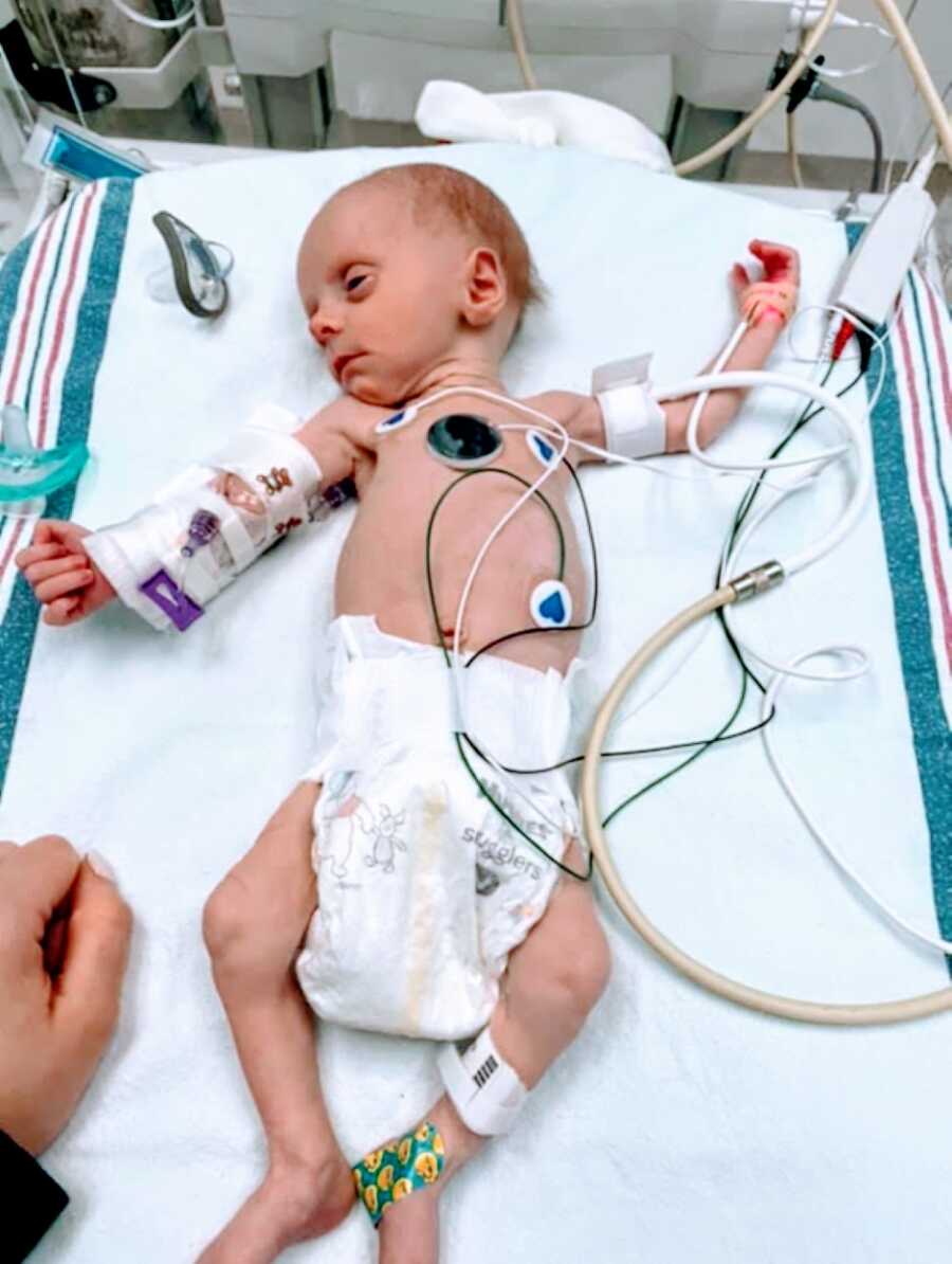 Little boy battling rare Trichohepatoenteric syndrome looks very sickly while connected to a bunch of wires in the hospital