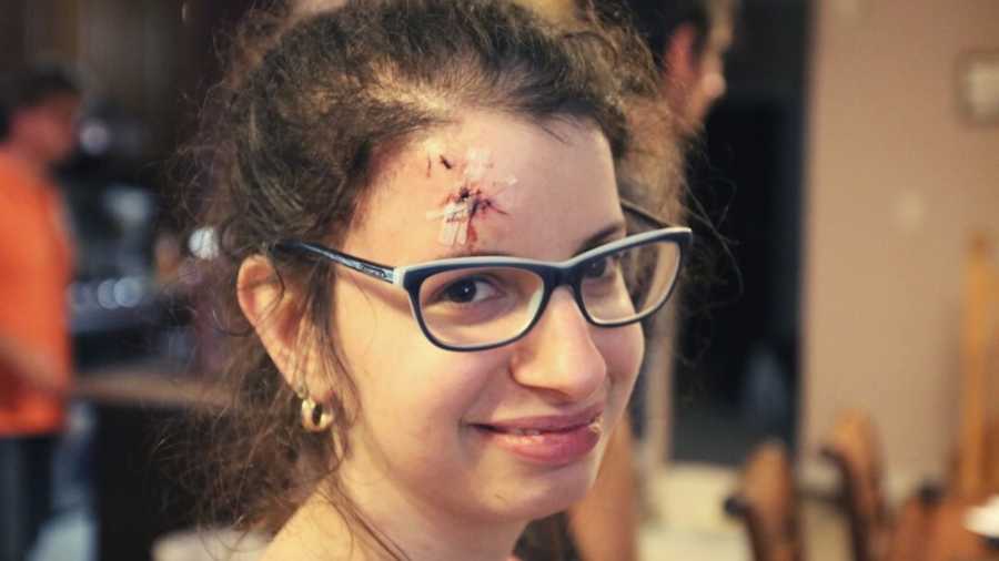 girl with forehead wound