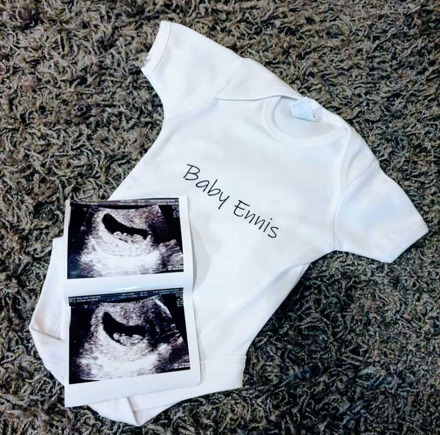 A baby jumper and a sonogram picture