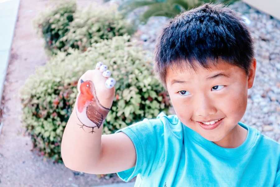 Little boy with limb difference has bird drawn on his arm