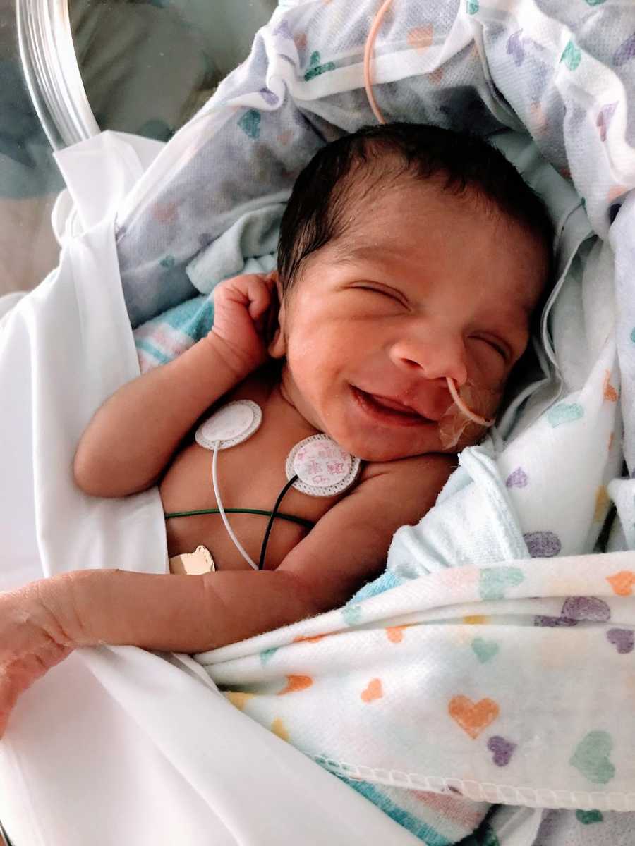 A baby girl with tubes and wires attached in hospital blankets