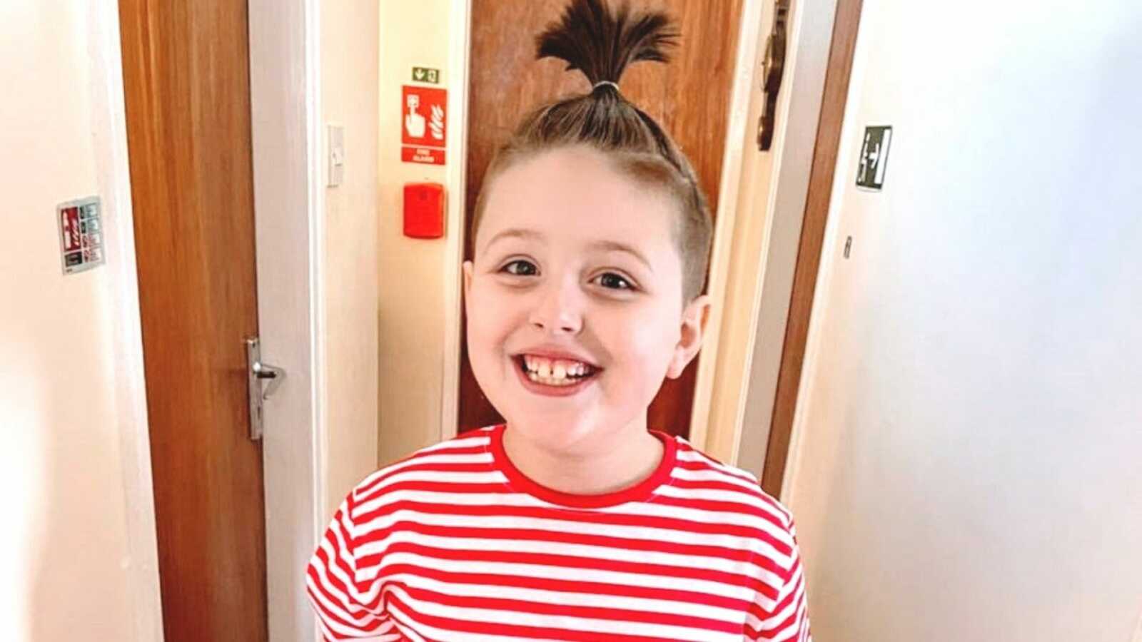Boy with autism wearing red striped shirt