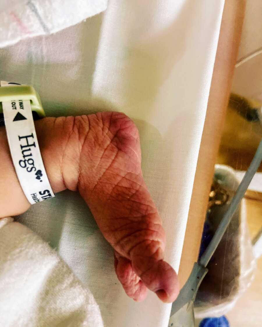 Mom snaps photo of her newborns foot with a NICU bracelet attached to his ankle
