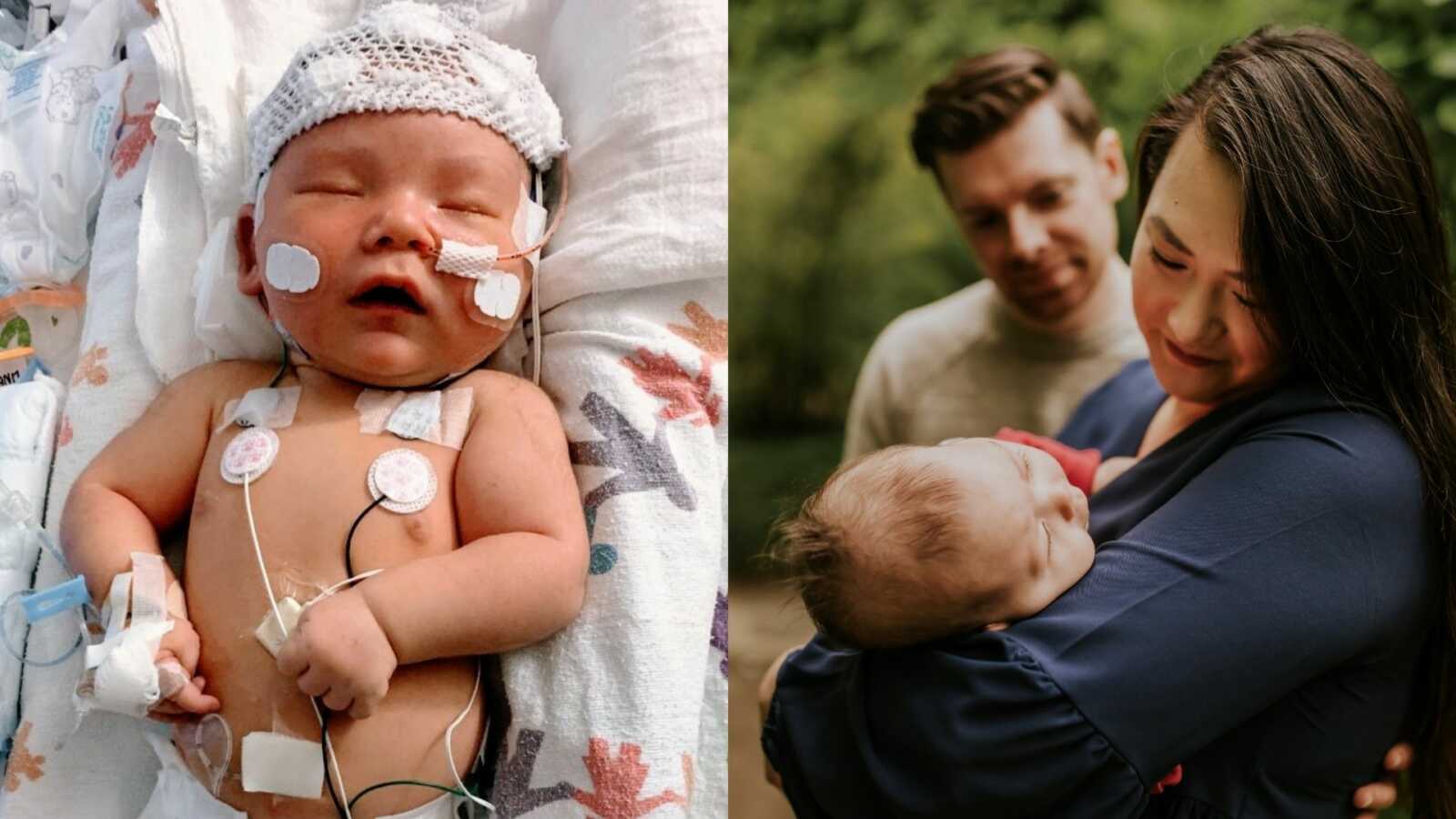 First time parents share photos of their newborn medically complex daughter