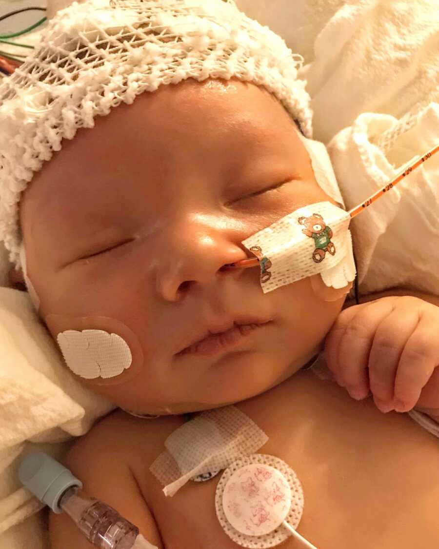 Newborn little girl sleeps in the NICU while being monitored by an EEG