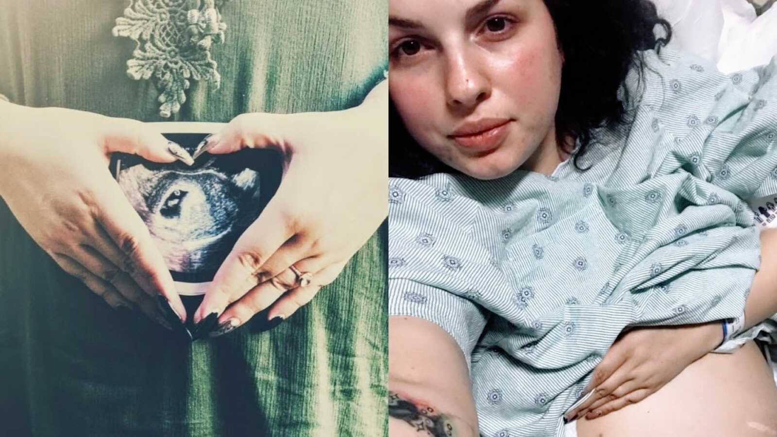 一位女士展示了她怀孕过程中的照片，包括一张超声波照片和一张医院照片