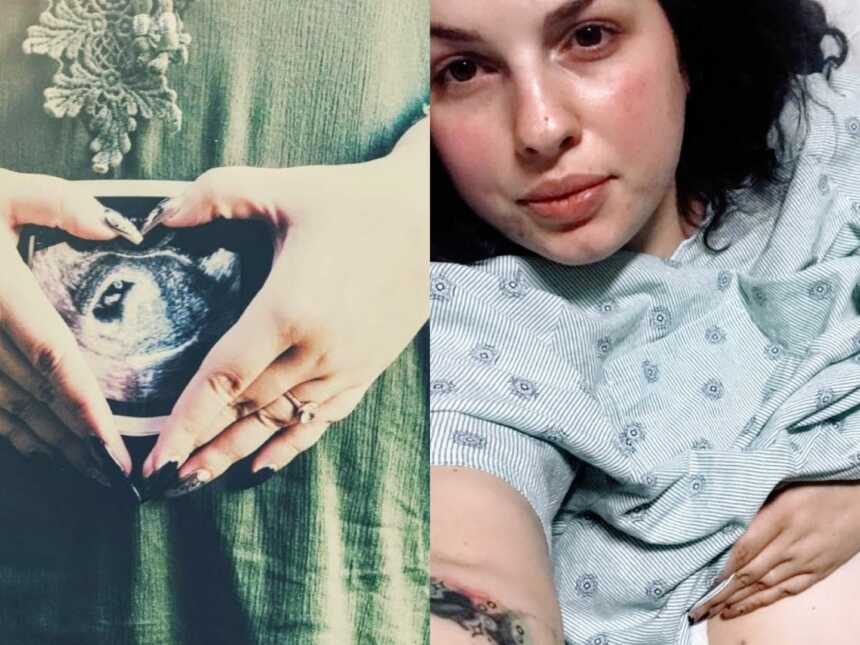 一位女士展示了她怀孕过程中的照片，包括一张超声波照片和一张医院照片