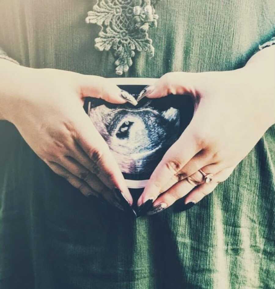 Woman takes a pregnancy announcement photo with an ultrasound scan photo