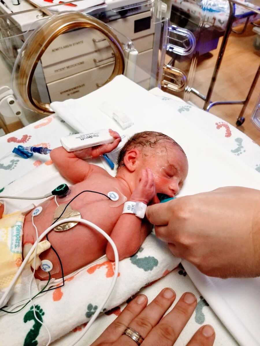 妈妈拍下了她第三个孩子的照片，第一个女儿，挂在新生儿重症监护室的管子上