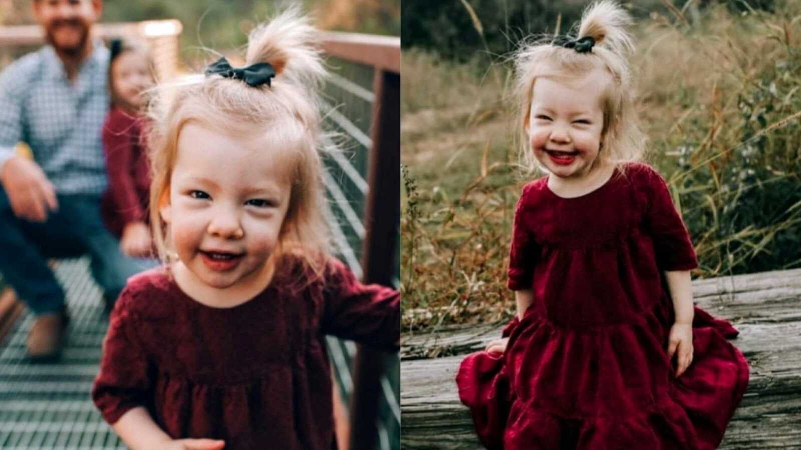 Daughter with Coffin-Siris Syndrome smiles big in a red velvet dress during a family Christmas photoshoot