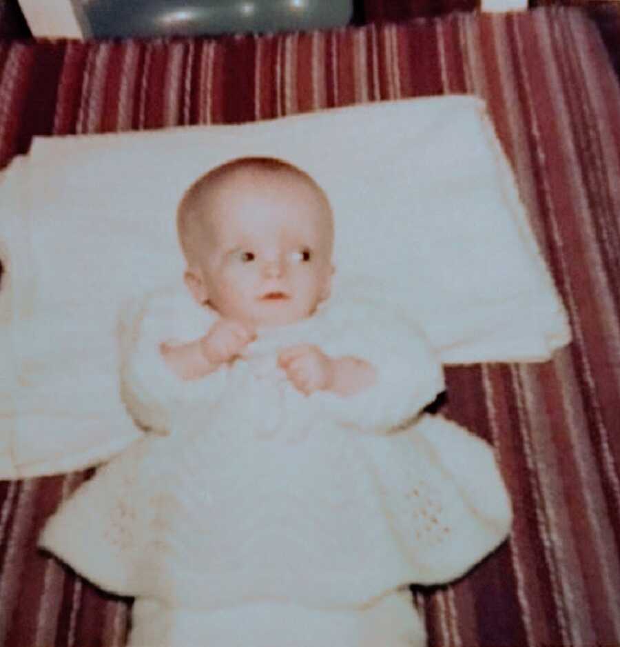 A baby girl with Russell-Silver Syndrome lying on her back