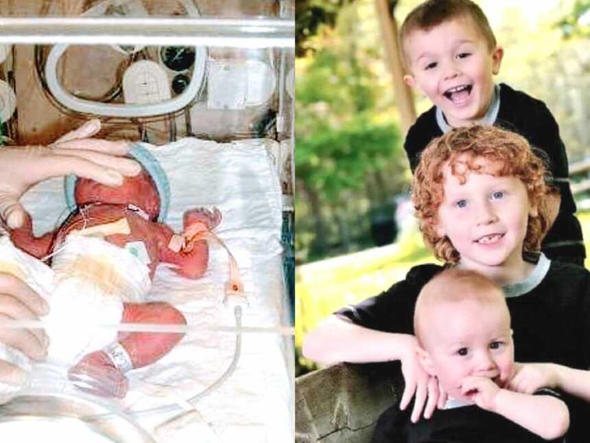 一个新生儿监护室的双胞胎和三个兄弟，包括一个非双胞胎