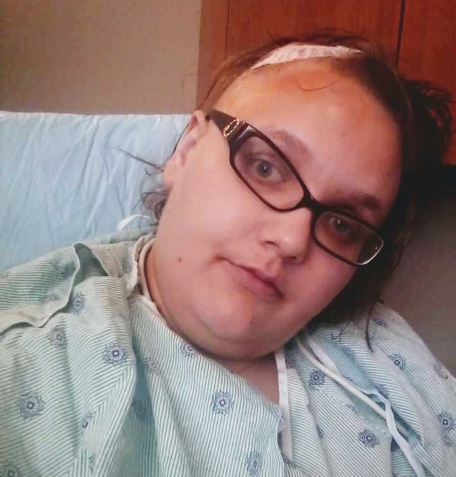 Woman post brain surgery