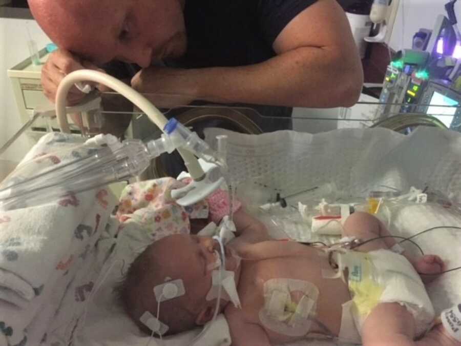 baby hooked up to multiple machines to survive