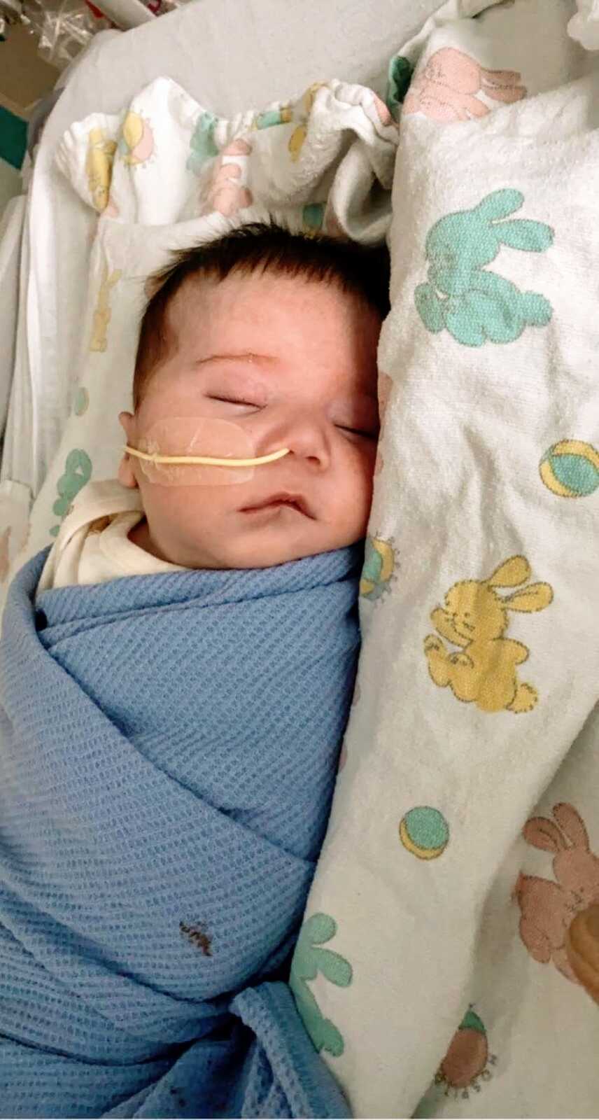 出生在稀有染色体缺失的小男孩在医院的Nicu睡觉