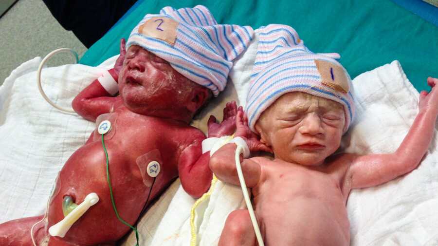 preemies born 