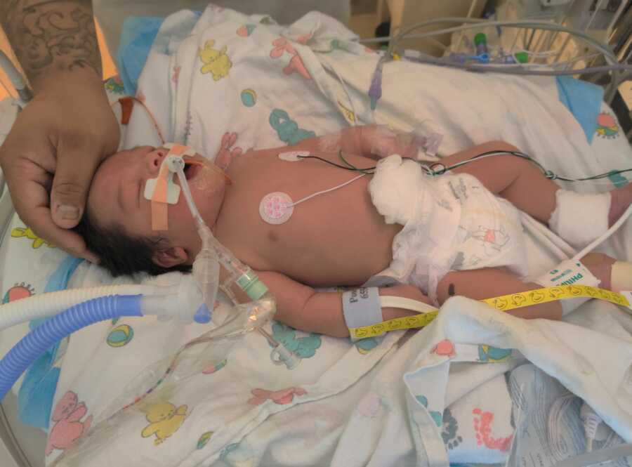婴儿斯特林在医院里为生命而战。